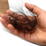 hair loss side effect steroid