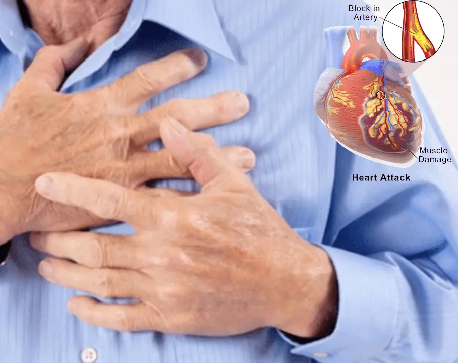 side effect of steroids Risk of heart attack