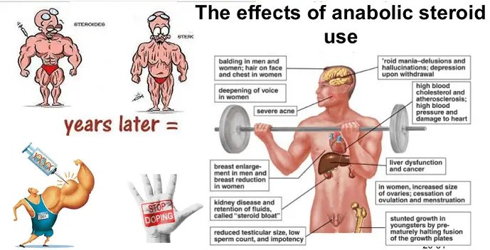 The Side Effects of using Anabolic Steroids
