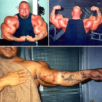 steroids anabolic steroids side effects pictures